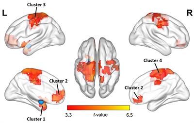 Exposure to Criticism Modulates Left but Not Right Amygdala Functional Connectivity in Healthy Adolescents: Individual Influences of Perceived and Self-Criticism